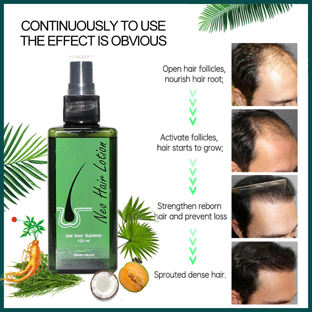 4 pcs Neo Hair Lotion 120ml Ha - Biotin Hair Growth 评论和价格